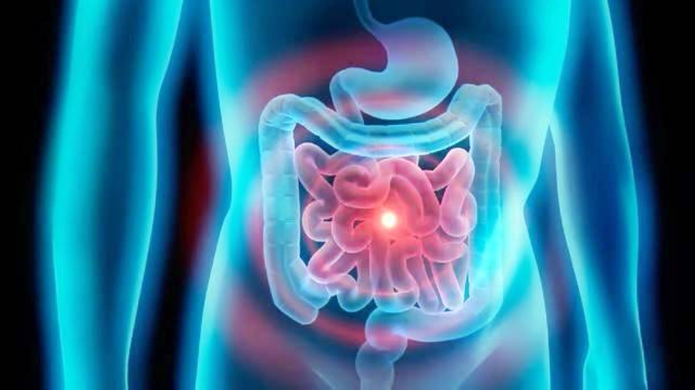 بروتين «Ku70» قد يوقف انتشار سرطان الأمعاء !