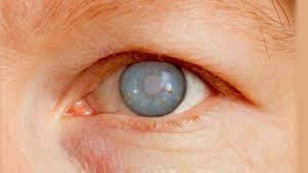 حرامي البصر!