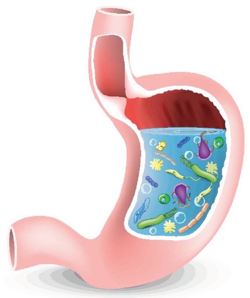 أنت مصاب ببكتيريا المعدة الحلزونية!