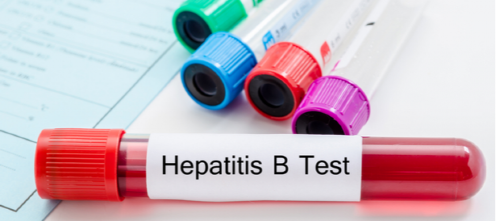 جراء هجوم قرود.. أول إصابة بشرية بـ “فيروس B” في هونغ كونغ.. فما هو؟