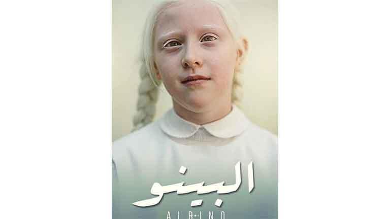 حسام داغر يعلن اختيار فيلمه القصير “ألبينو” في مهرجان مدريد السينمائي