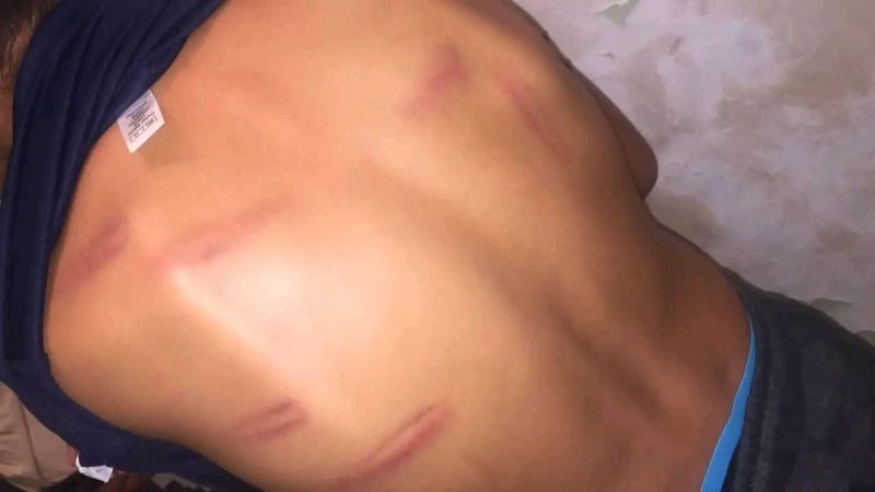أستاذ للتربية الإسلامية يعنف تلميذه بوحشية بنواحي كلميم