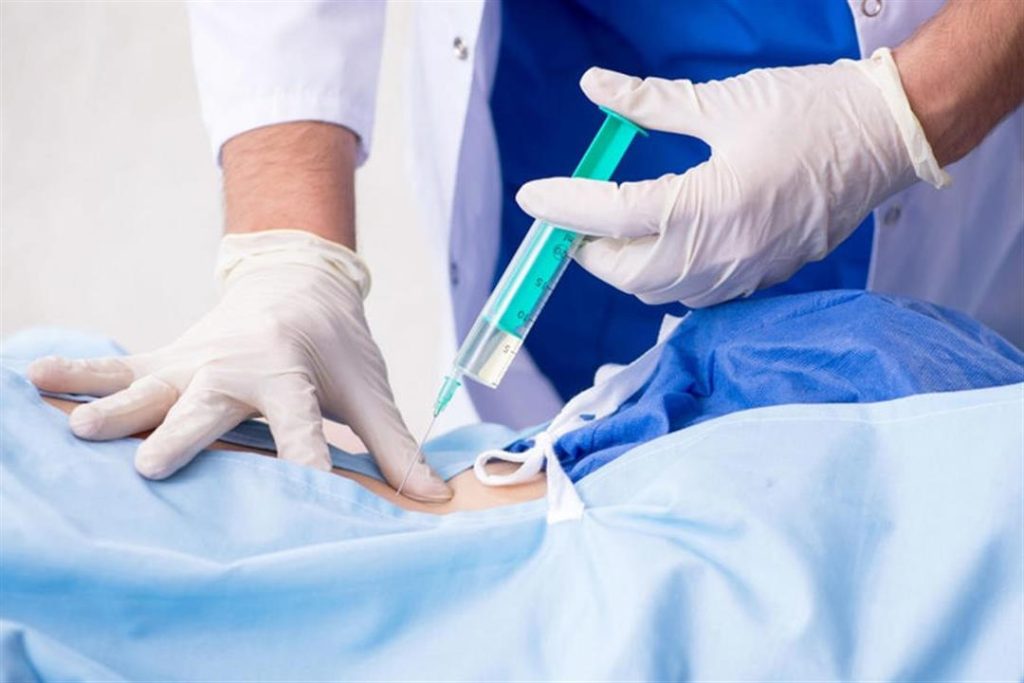 لن تتخيل.. تفاصيل مهمة عن حقنة الظهر أثناء الولادة