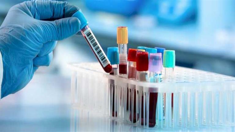 فحص دم ثوري يكشف 19 نوعا من السرطان قبل 7 سنوات من ظهور الأعراض