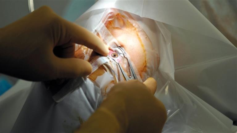 شاب يخضع لعملية زراعة قرنية والسبب “فرك” عينيه… هذا ما حدث