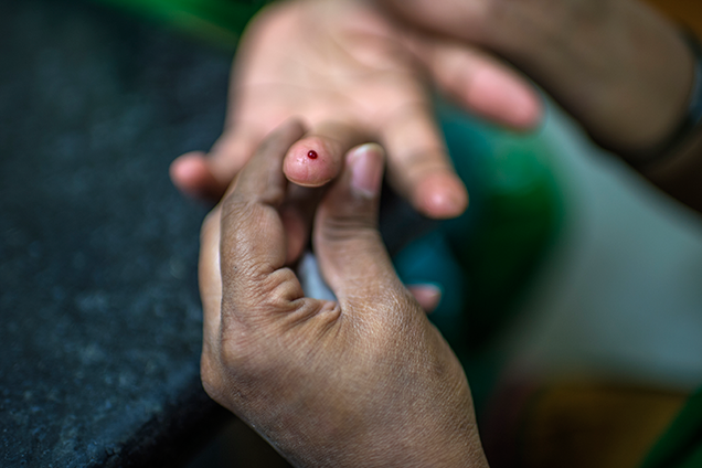 أطباء: الدولة تستطيع فقط توفير العلاج لمليون و200 ألف مصاب بالسكري من أصل 3 ملايين