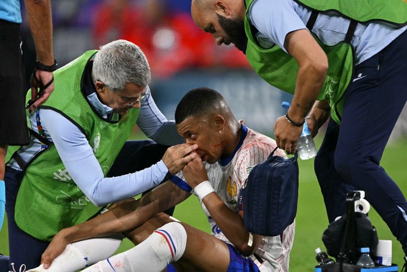 إصابة كيليان مبابي بكسر في الأنف