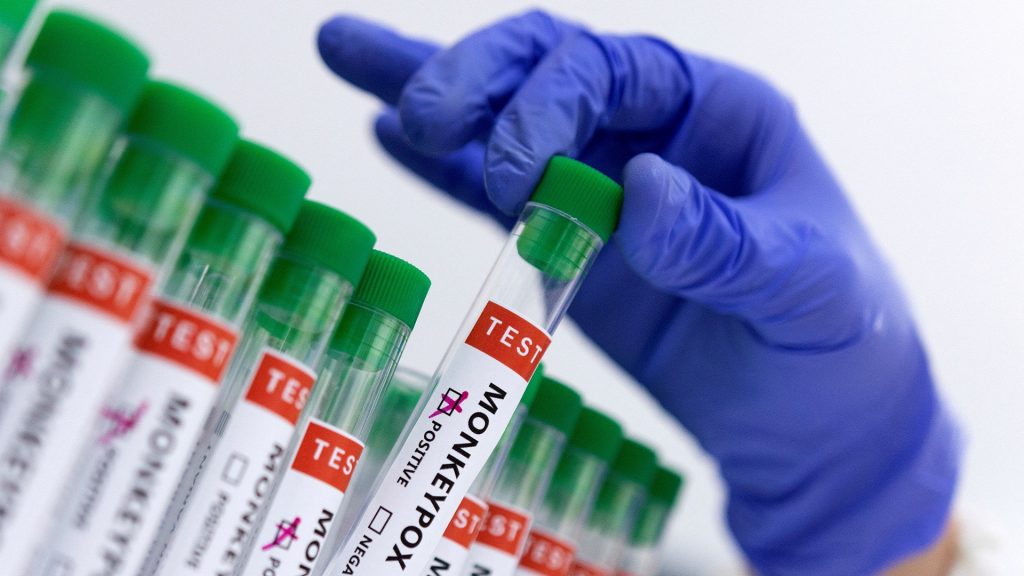 ارتفاع حالات الإصابة بجدري القردة في نيجيريا إلى 48