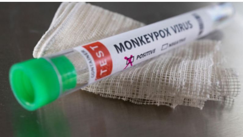 هذه طرق حماية الأطفال من جدري القرود