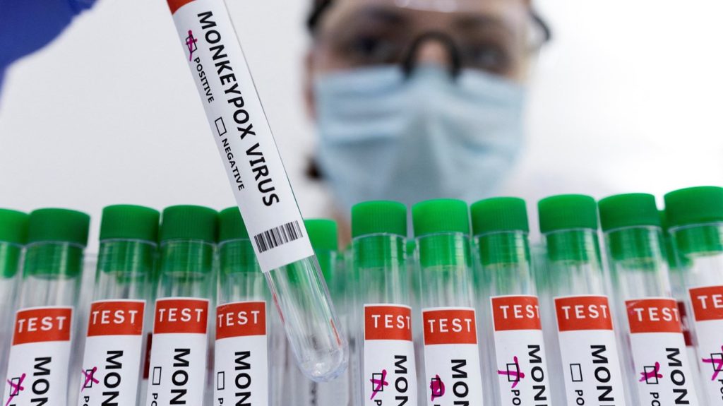 باكستان تسجل الإصابة الـ4 بفيروس جدري القردة في بيشاور