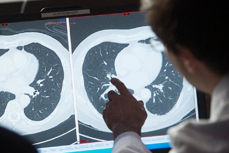 حملة للكشف عن سرطان الثدي بالعرائش