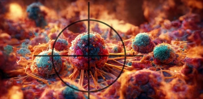 كيف يساعد الذكاء الاصطناعي في تشخيص سرطان الجلد؟.. قدرات مذهلة