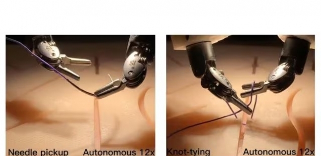 روبوت يجري عملية جراحية بمهارة الطبيب.. هل يساهم في إنقاذ حياة المرضى؟