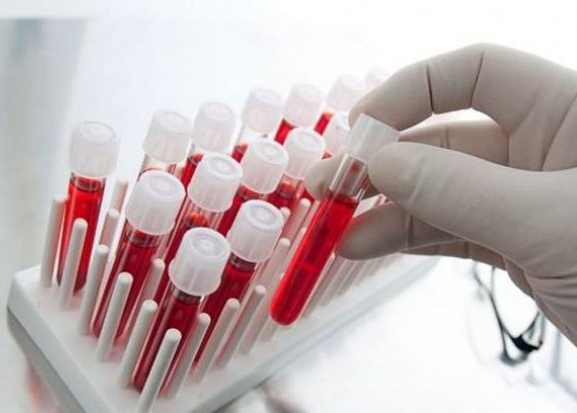 أعراض تؤكد إصابتك بفقر الدم والأنيميا.. راقبها جيدًا