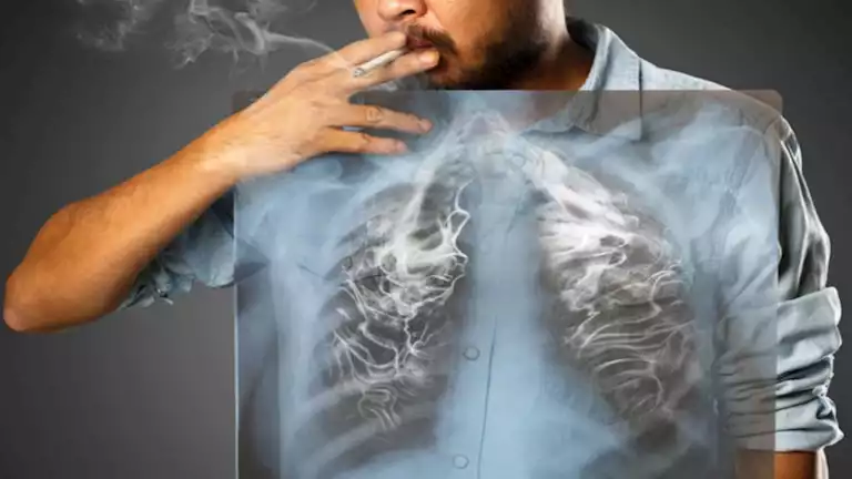دراسة علمية تكشف كيف يؤثر التدخين على صحة الرئتين