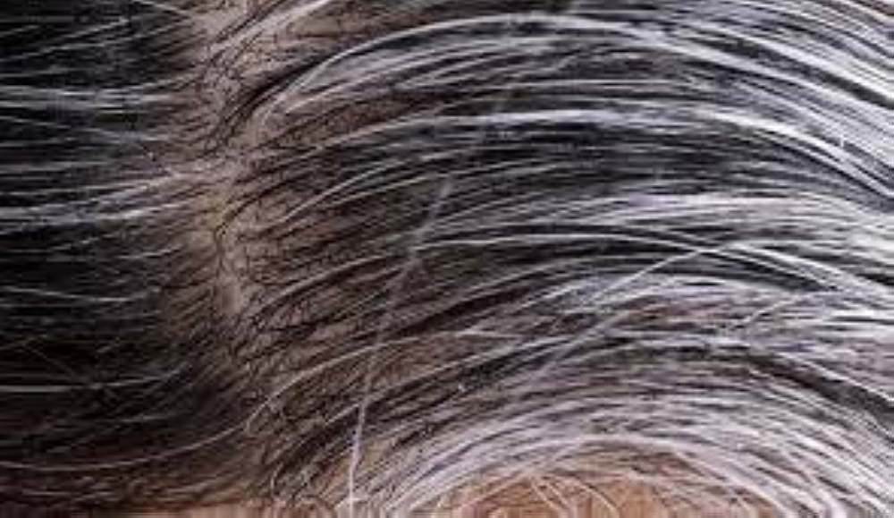 5 أطعمة يمكن أن توقف شيب الشعر