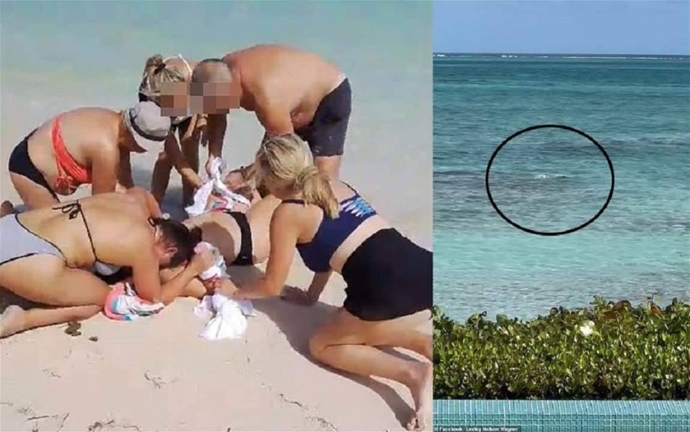 بتر يدي امرأة كندية تعرضت لهجوم قرش في جزر توركس