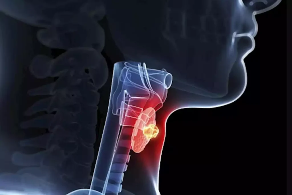 5 أعراض واضحة تدل على التهابات الغدد الجار درقية