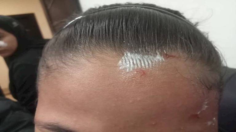 “اعتداء على لاعبات ومستشفى”.. مصراوي يكشف ما حدث في مباراة الاتحاد وإنبي بدوري السيدات (صور)