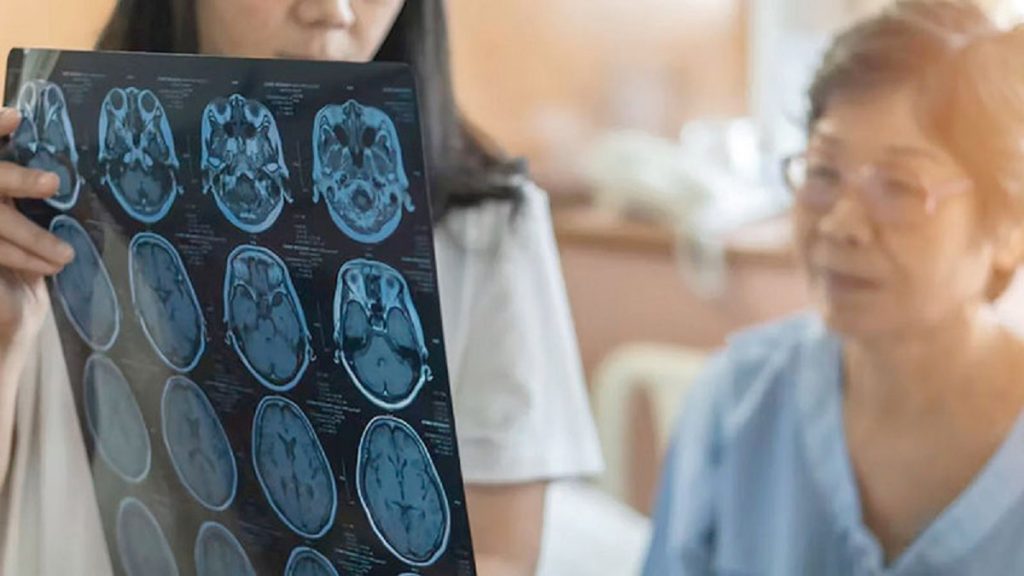 أعراض الإصابة بالزهايمر المبكر في منتصف العمر.. هل النسيان ناقوس خطر؟