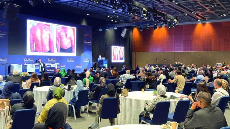 علاجات جينية جديدة في الدولة لأمراض جلدية نادرة