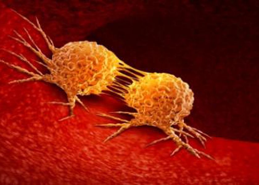 لا تتجاهل الإشارات الصامتة.. 18 علامة قد تنقذ حياتك من السرطان