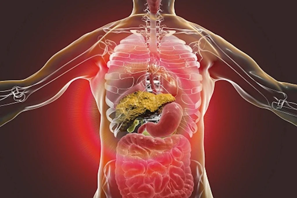 عند إصابتك في هذا المكان بجسدك.. 5 علامات قوية تكشف عن وجود “تليف الكب