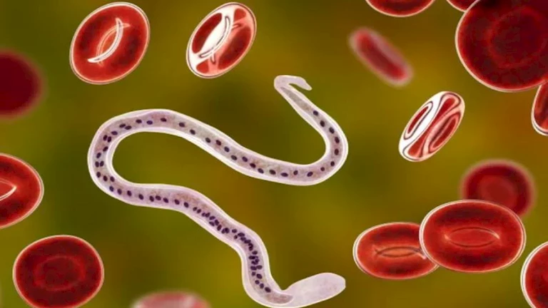 10 علامات تدل على الإصابة بالديدان الطفيلية