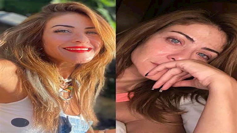 آخرهن نجلاء بدر.. فنانات اعترفن بالخضوع لعملية شد الوجه