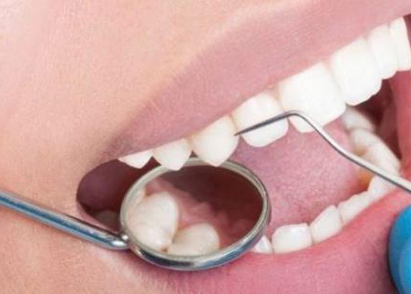 صحة فمك مرآة لقلبك.. رابط خفي بين اللثة والأوعية الدموية