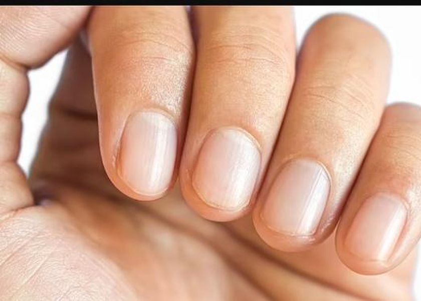 علامة في أطراف أصابعك قد تكون إنذارا للإصابة بسرطان الرئة