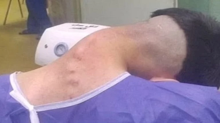 شاب يتعرض للخطر بسبب الإدمان.. إليك ما حدث