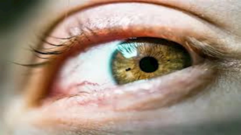 احذر.. 3 أعراض خطيرة لـ جلطة العين وهذه طرق الوقاية