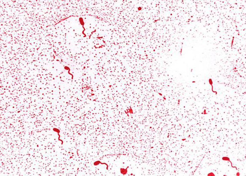تسجيل 79 حالة إصابة.. انتشار بكتيريا تهدد الحياة في أمريكا بسبب بيض المزارع