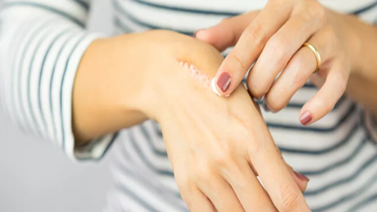 لماذا نشعر بالألم حتى بعد زوال سببه؟