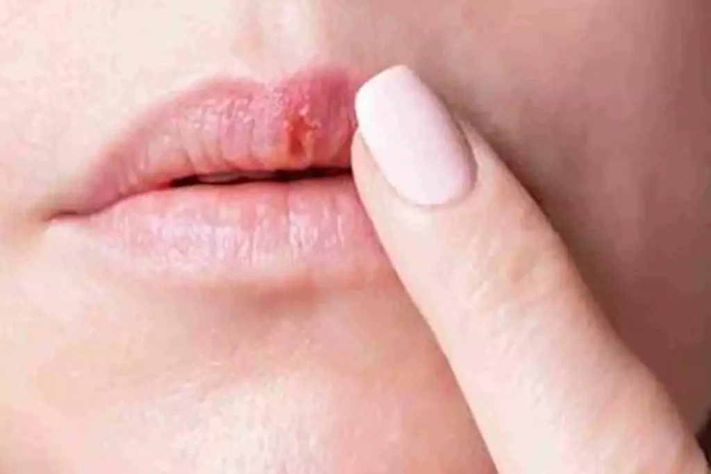 الشفاه مرآة صحتك.. علامات لا تتجاهلها