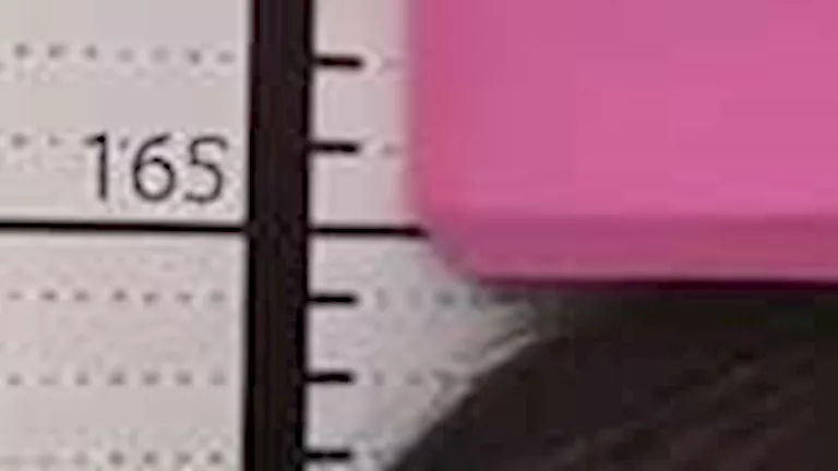 مراهق ينفق آلاف الدولارات على علاج لزيادة الطول.. لكن المفاجأة كانت صا