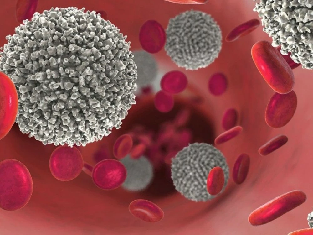 اختراق طبي روسي.. تقنية جديدة تضاعف فعالية أدوية سرطان الدم 8 مرات!