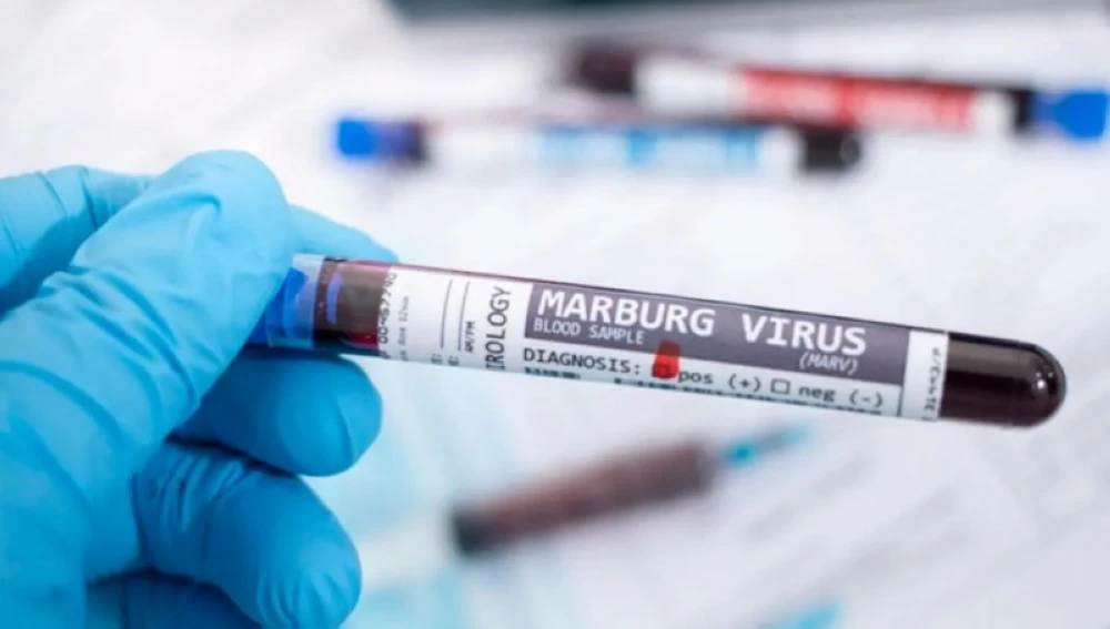إثيوبيا تعلن تفشي وباء «ماربورغ»